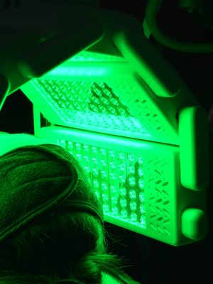 Photobiomodulation_2